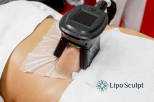 Does Fat Freezing At Home Work? 3 Fat freezing at home from Lipo Sculpt Swindon