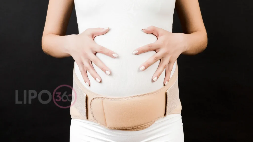 Do Belly Bands Help Prevent Diastasis Recti? 2 How Belly Bands Work, and What They Don't Do